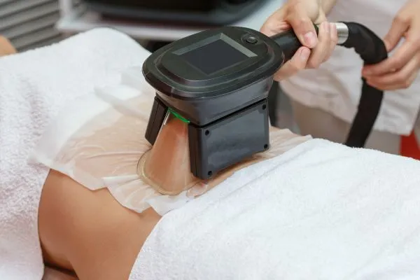Image of person having fat freezing treatment to help weight gain Christchurch