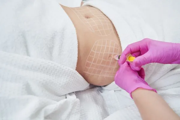 image of fat dissolving injections on love handles to help combat weight gain Christchurch