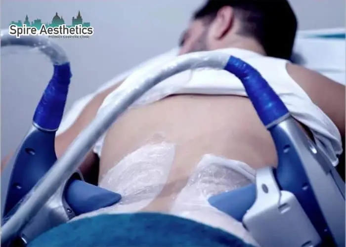 Man having fat freezing treatment done on love handles before a competitions Christchurch to create a sculpted look.